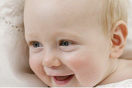 宝宝得了湿疹都有哪些症状？