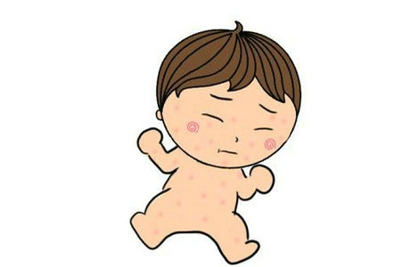 宝宝的湿疹是怎么引起的？