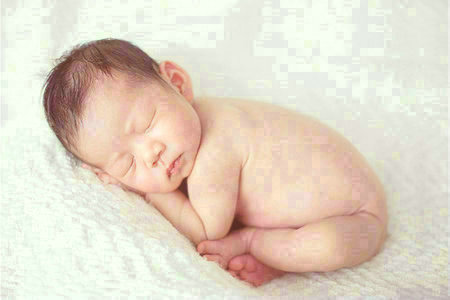 新生儿黄疸有哪些特点？